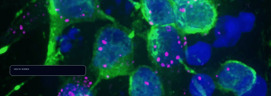 Parkinson's-linked α-synuclein blocks protein transport in neurons illustration