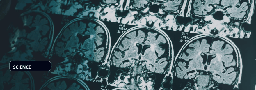 Brain wiring patterns linked to harm avoidance in obsessive-compulsive disorder illustration