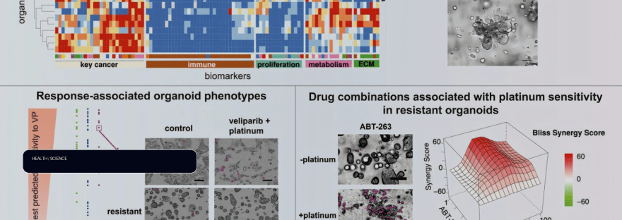 Patient-derived organoids reveal which breast tumors may resist standard therapies illustration