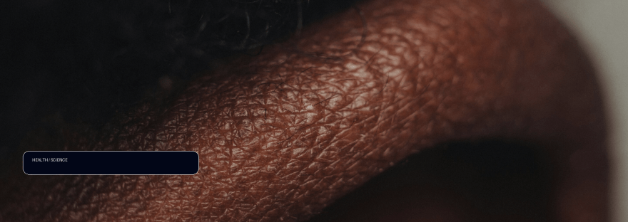 Melanoma treatment mystery gets new answers from mathematical model illustration